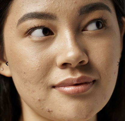 SKINPURE : Sublimez Votre Peau Equilibrée, Nette Et Sans Imperfections